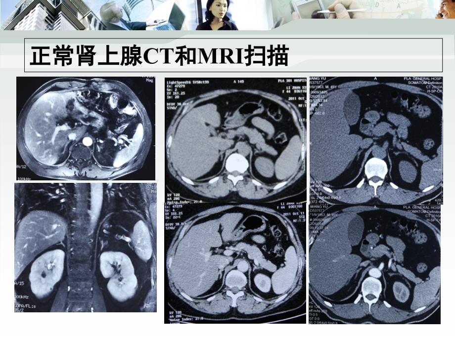 双侧肾上腺疾病的影像学特点课件_第1页