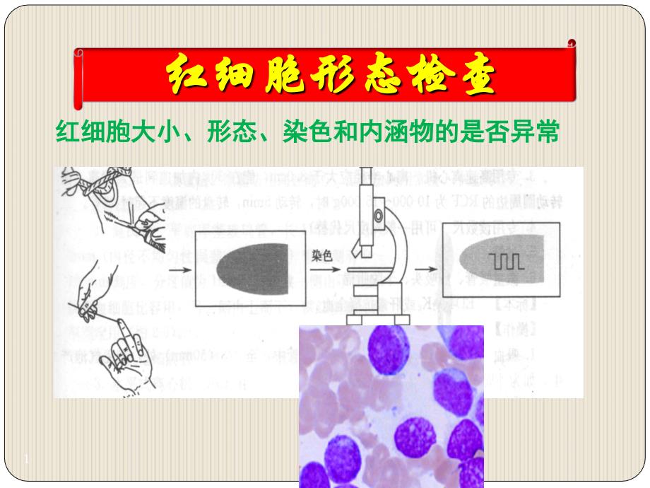 医学课件红细胞形态学检验_第1页