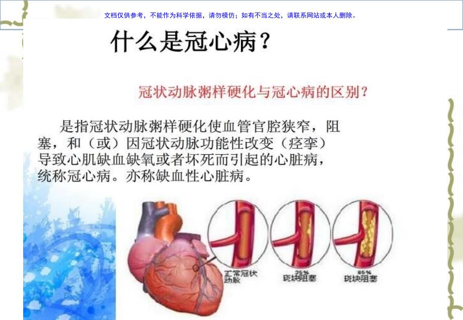 冠状动脉PCI(CAG术的护理课件_第1页