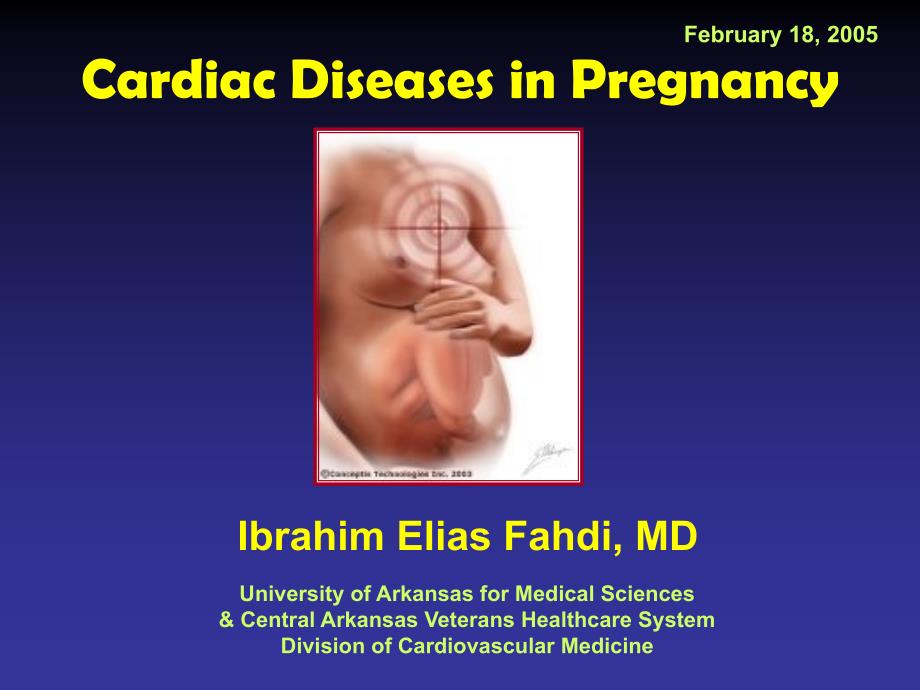 Cardiac Diseases in Pregnancy - University of Arkansas for 心脏病在妊娠-阿肯色大学_第1页