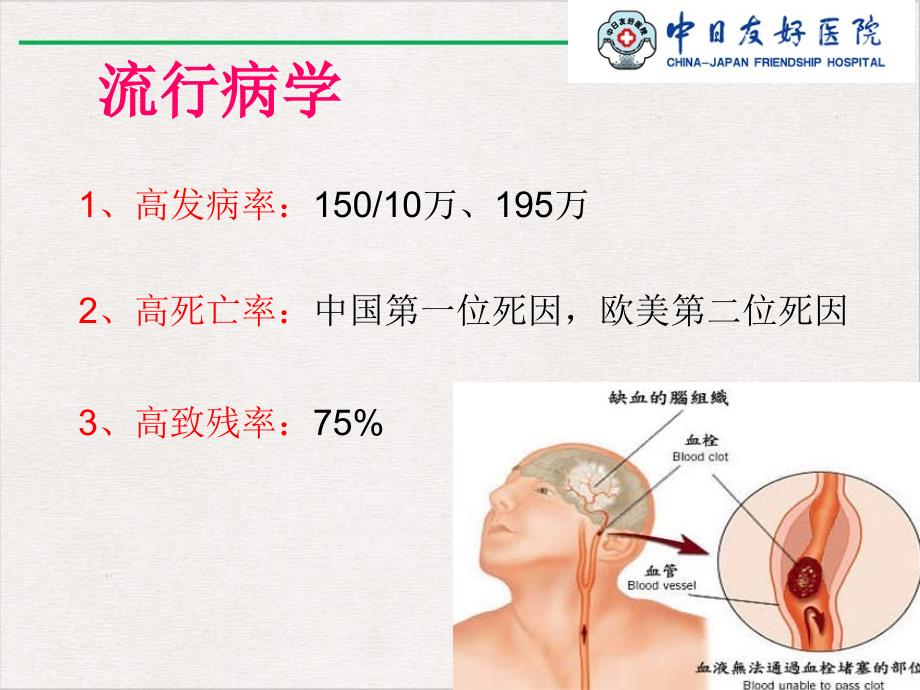 静脉溶栓的护理课件完整版_第1页