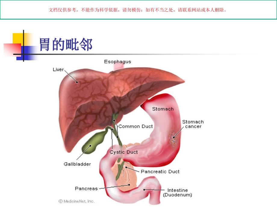 胃癌护理教学培训课件_第1页