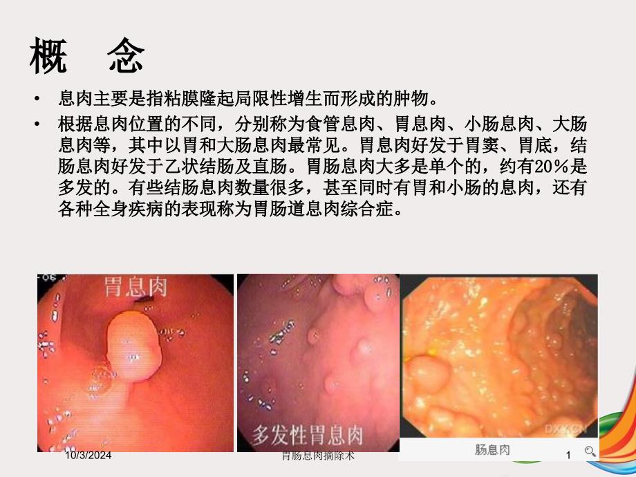 胃肠息肉摘除术培训课件_第1页