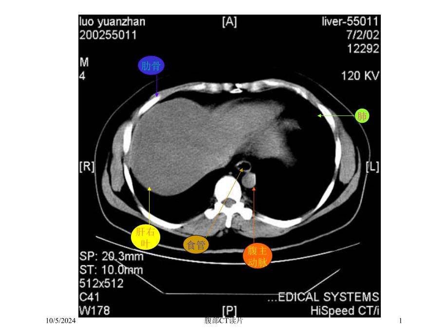 腹部CT读片培训课件_第1页