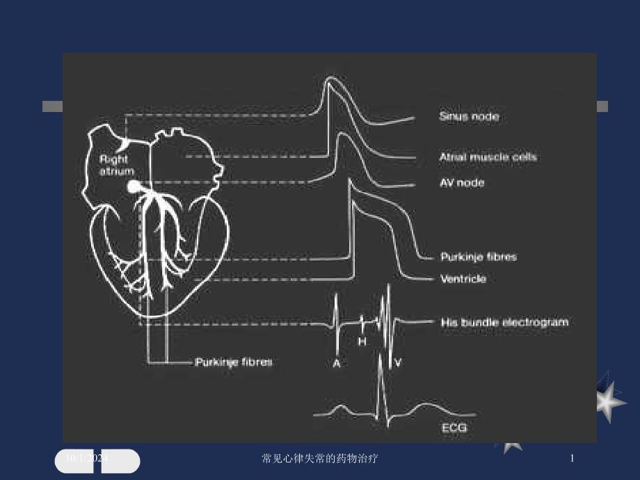 常见心律失常的药物治疗课件_第1页