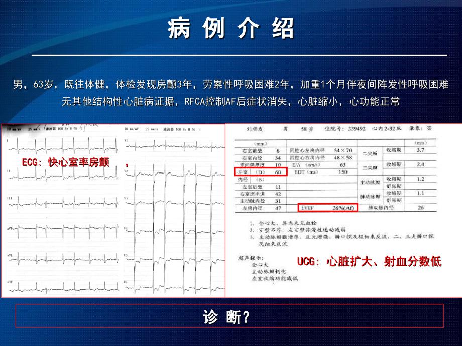 重新认识心律失常性心肌病培训课件_第1页