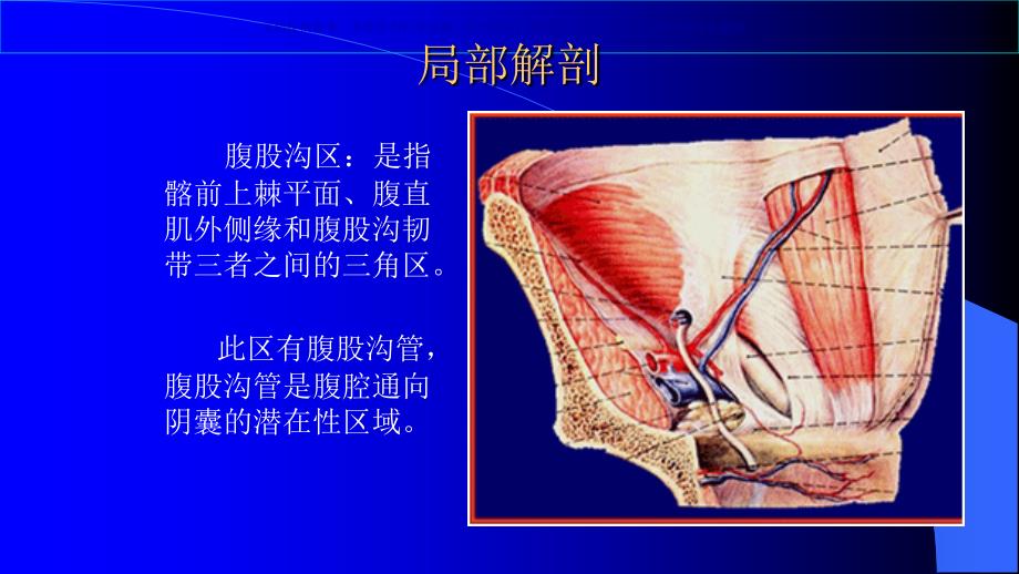 腹腔镜疝修补术医疗护理查房课件_第1页