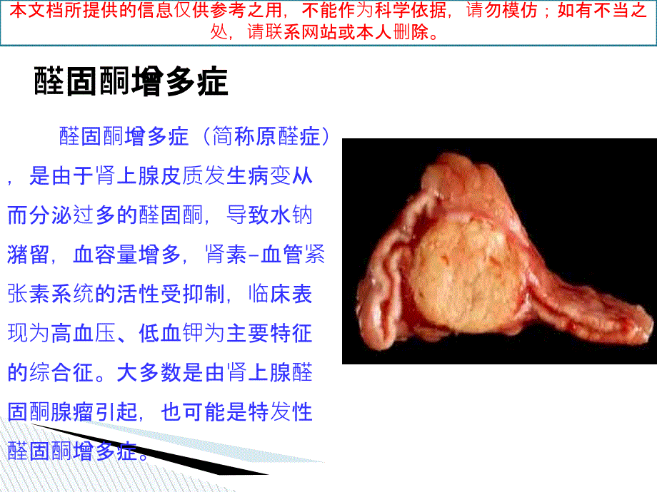 醛固酮增多症培训课件_第1页