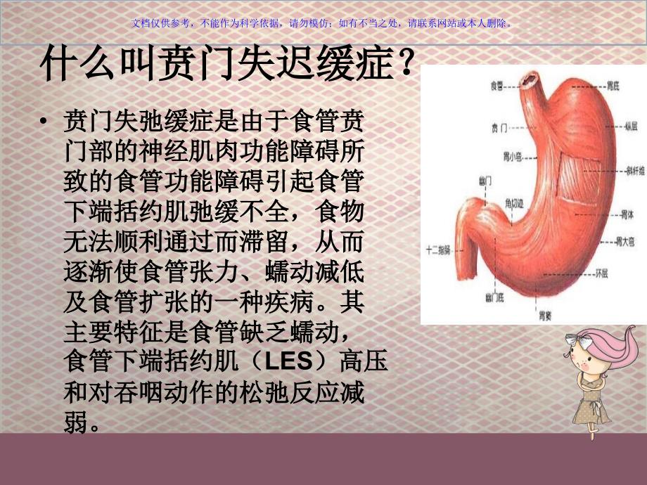 贲门失弛缓症经口内镜下肌切开术课件_第1页