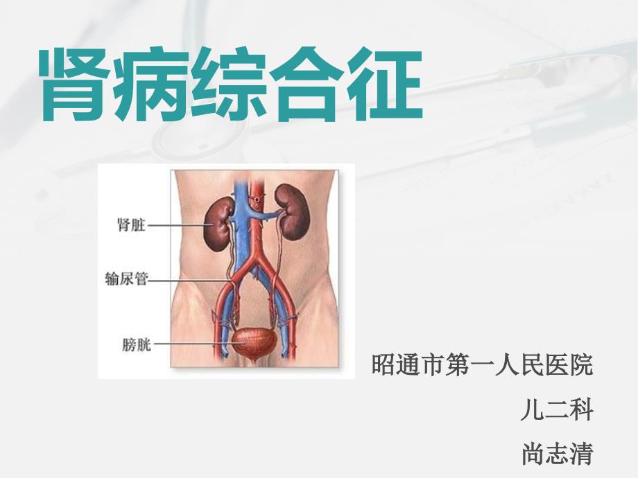 医学课件小儿肾病综合征_第1页