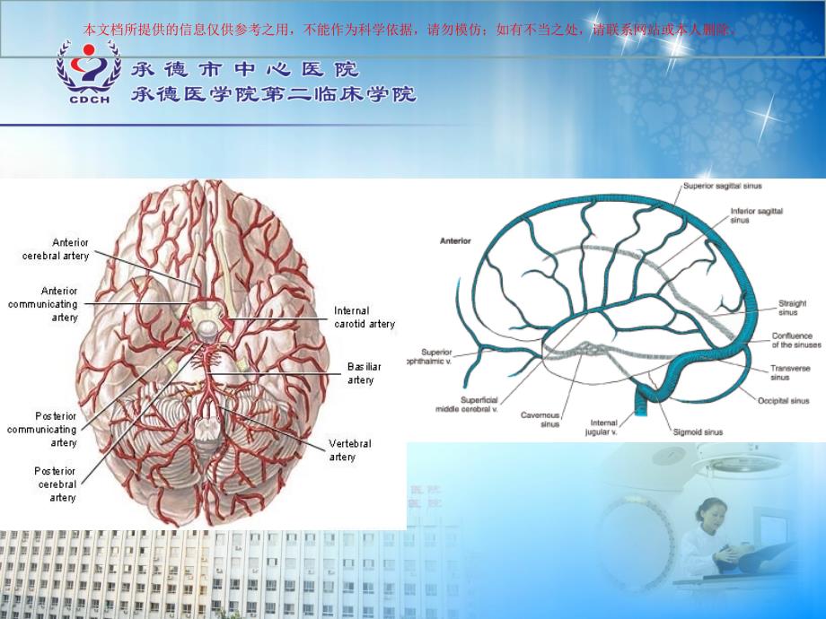 颅内动脉的分支与分段培训课件_第1页