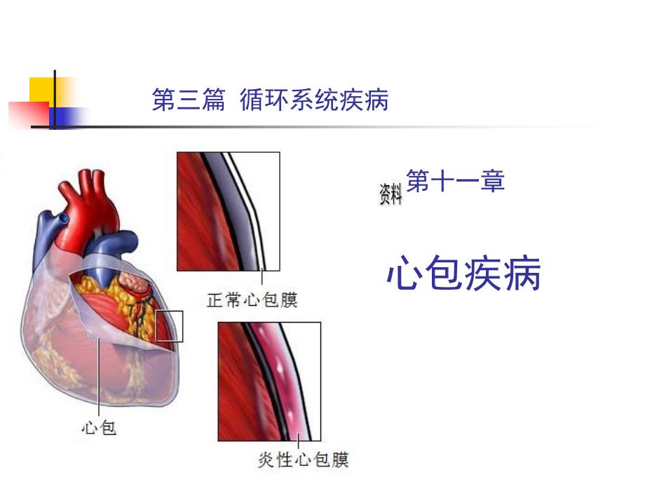 循环系统疾病--心包疾病_第1页