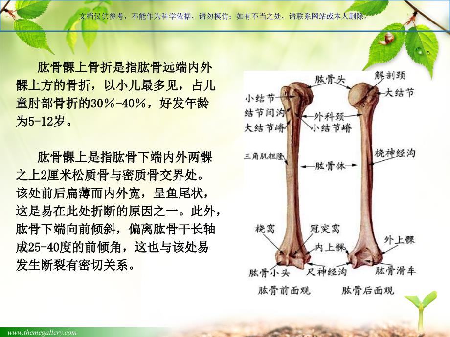 肱骨髁上骨折汇总课件_第1页