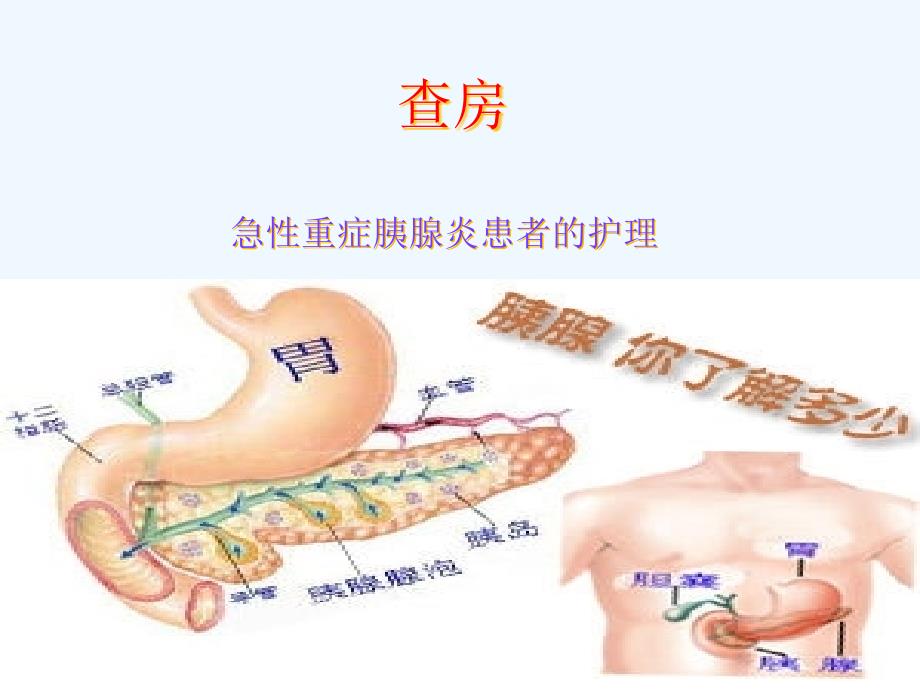 ICU查房(急性胰腺炎)[001]课件_第1页