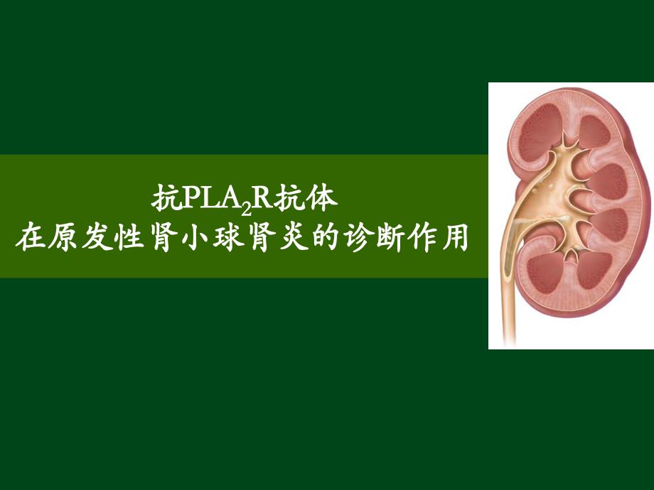 PLA2R在特发性膜性肾病诊断中的作用课件_第1页