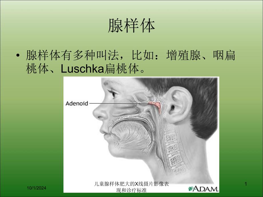 儿童腺样体肥大的X线摄片影像表现和诊疗标准课件_第1页