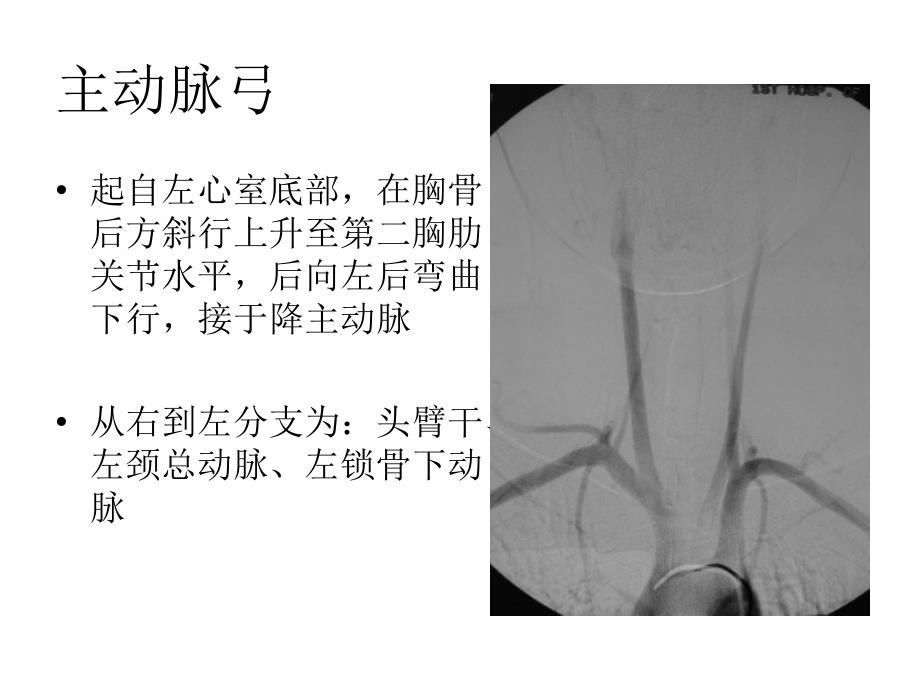 医学课件脑血管的正常变异和异常_第1页