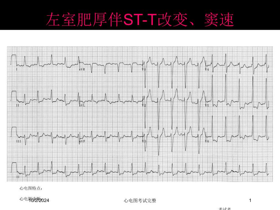 心电图考试完整培训课件_第1页