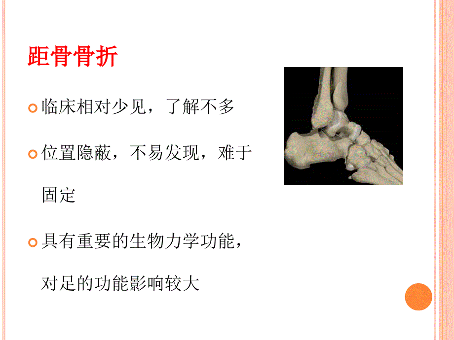 PPT医学课件距骨骨折的诊断与治疗策略讲义_第1页