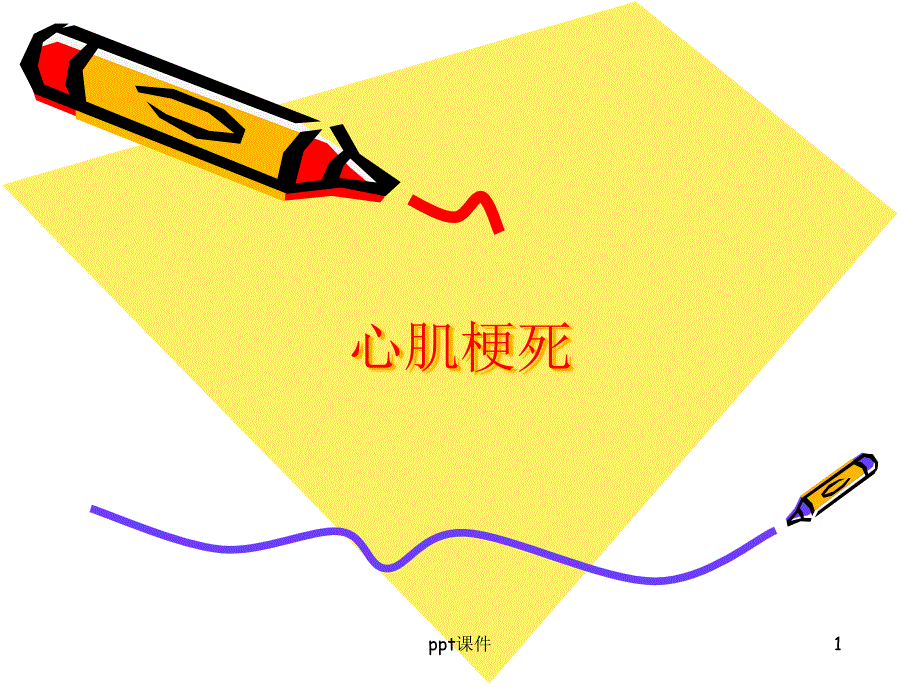 心肌梗死----课件_第1页