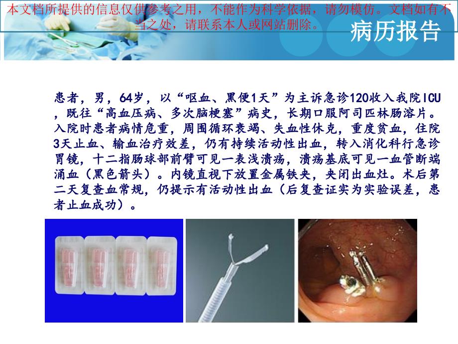 消化道出血医患沟通培训课件_第1页