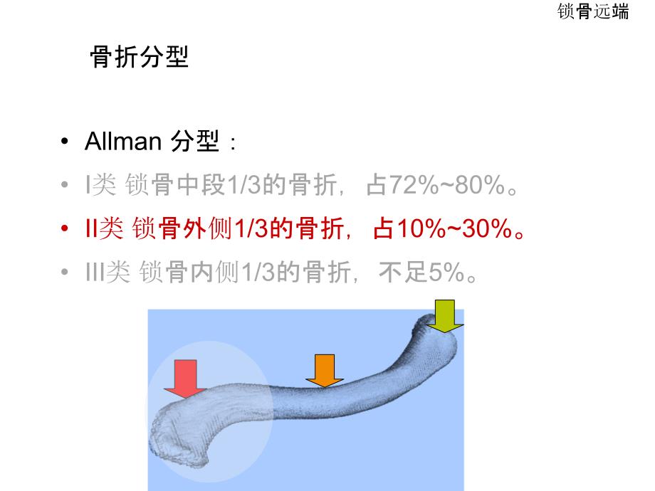 PPT醫(yī)學(xué)課件鎖骨遠(yuǎn)端骨折講義_第1頁