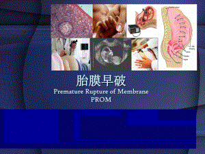 产科——胎膜早破产科学PPT课件