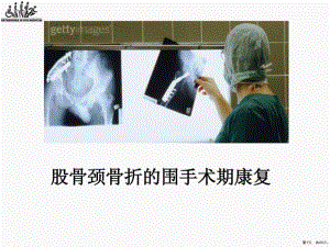 [整理版]股骨颈骨折围手术期康复课件(PPT 43页)