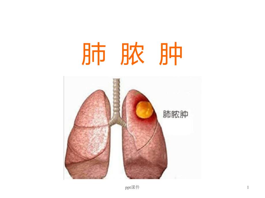 肺脓肿病人的护理ppt课件_第1页