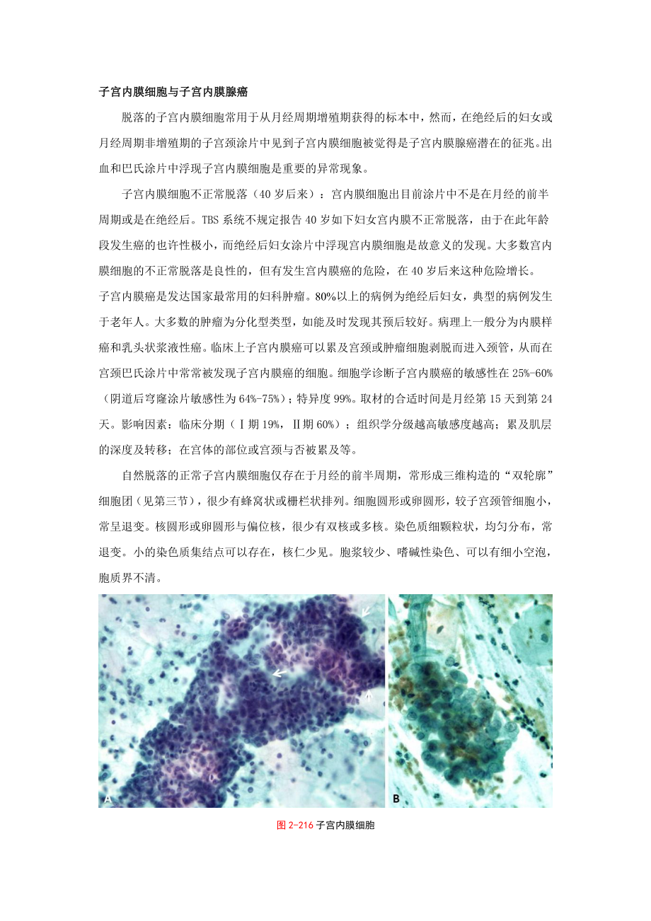 子宫内膜细胞与子宫内膜腺癌_第1页
