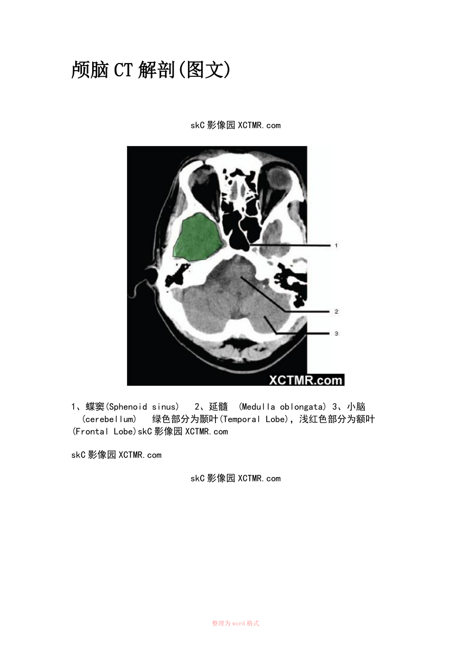 颅脑CT解剖带图解Word_第1页