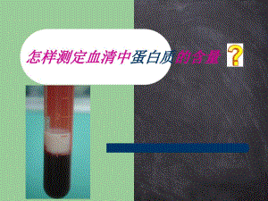 Lowry’s法Folin-酚试剂法-测定血清中蛋白质的含量