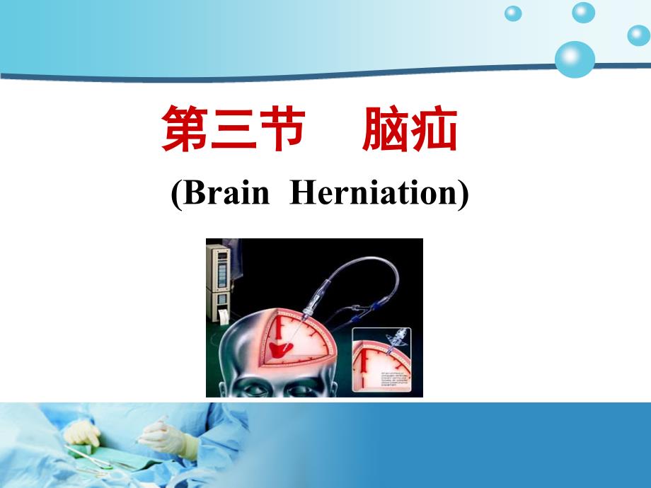 颅内压增高病人护理3_第1页