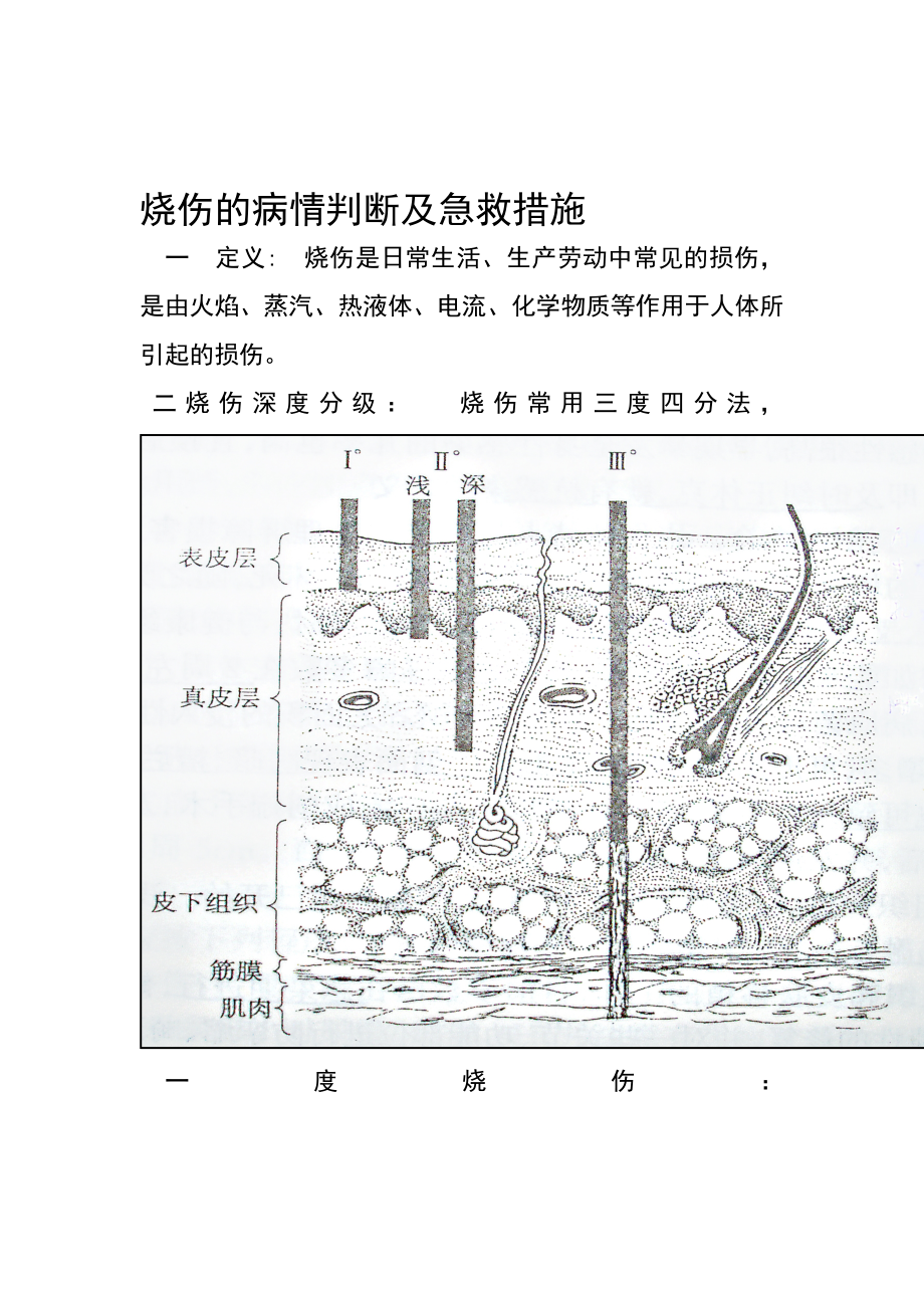 烧伤急救讲座准备_第1页