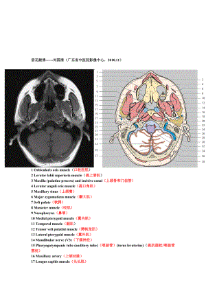 鼻咽部断层解剖图