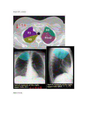 肺段在CT上的划分