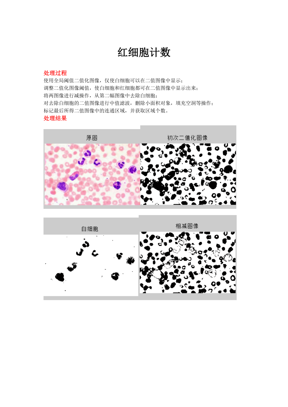 图像处理—红细胞计数(Matlab)_第1页
