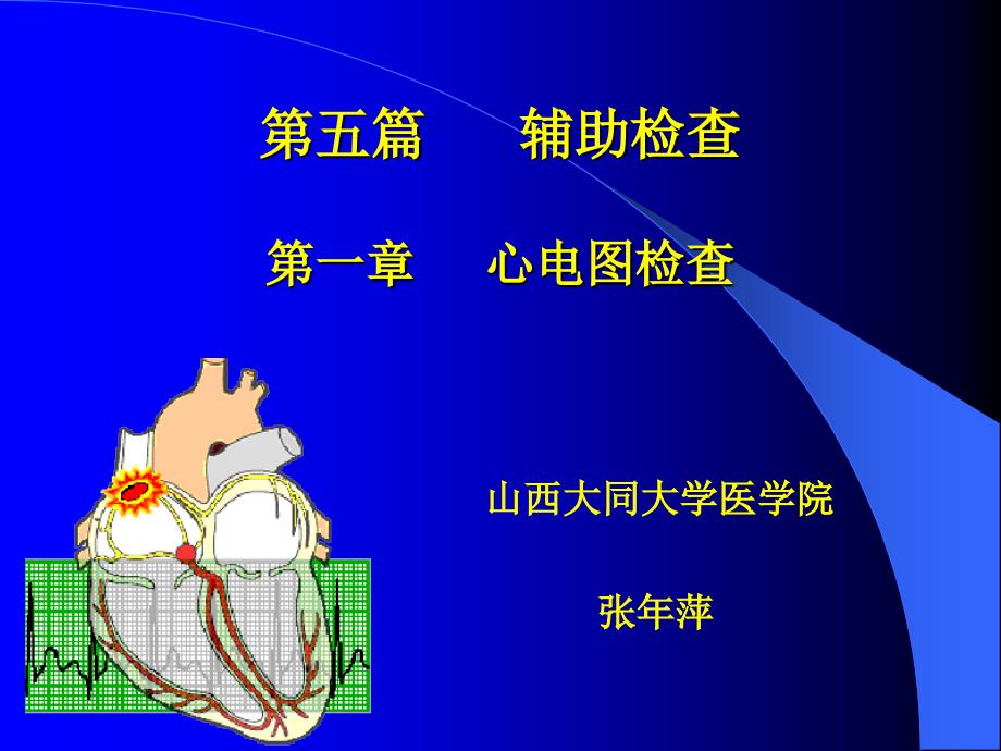 心电图讲义-第五篇 辅助检查第一章 心电图检查_第1页