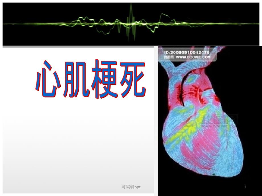 心肌梗塞1课件_第1页